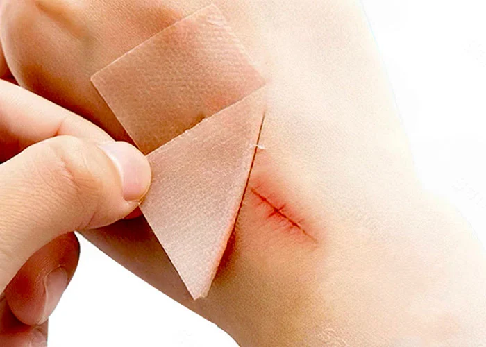 Waterproof Skin Toned Scar Patches For Sensitive Skin